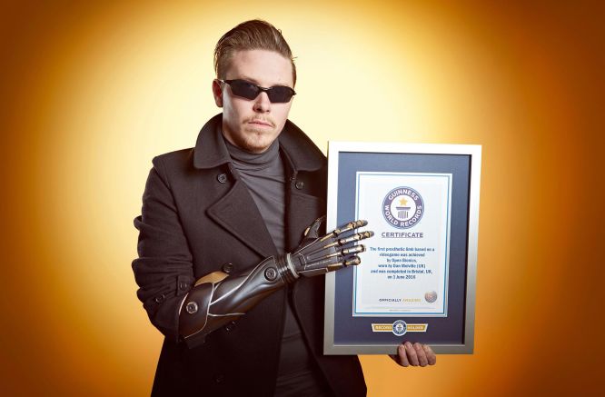 Młody Brytyjczyk otrzymał bioniczną protezę wzorowaną na ręce Adama Jensena z Deus Ex